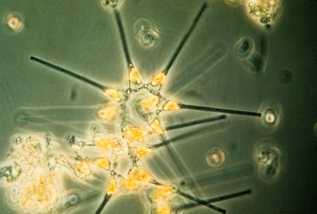 Phytoplankton give us summer’s green water