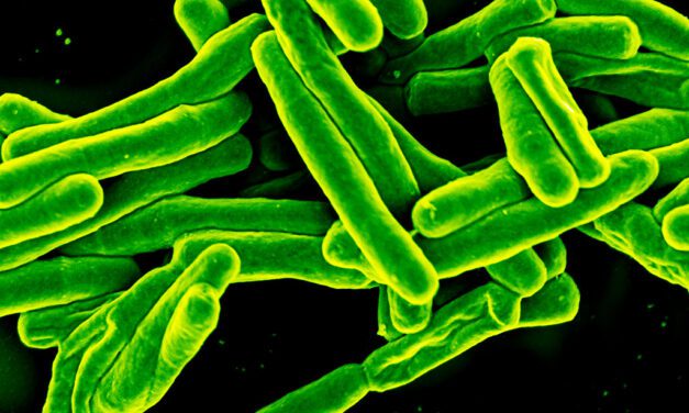 World TB Day raises awareness of continued impact of tuberculosis