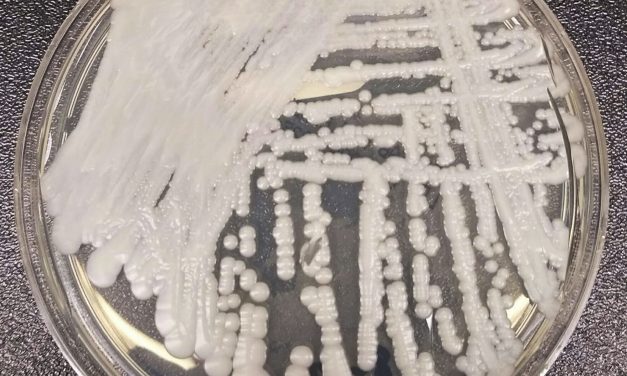 Why scientists are nervous about fungi